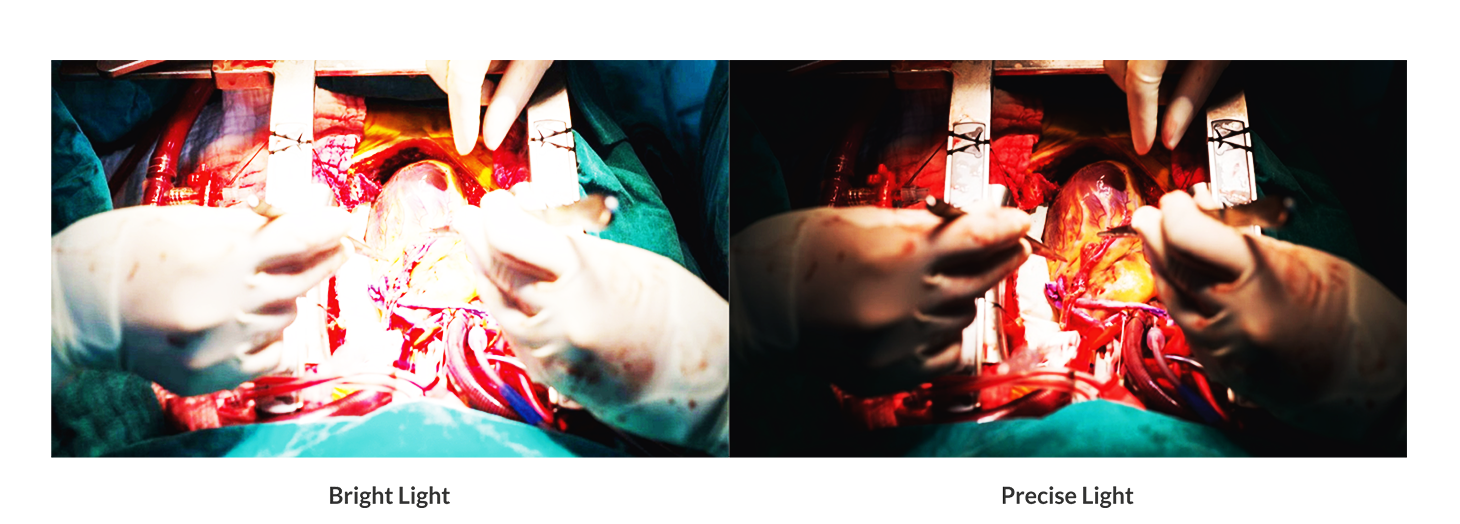 OT Light - Surgical OT Light